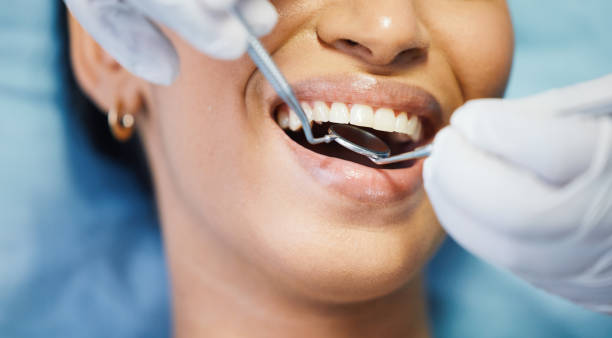 Best Walk-In Emergency Dentist in Cedarville, OH